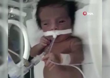 Hastalığı Teşhis Edilemeyen 5 Aylık Eymen’in Annesi, Ağlama Sesine Hasret